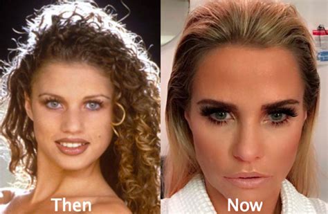 katie price pre surgery|katie price before and after.